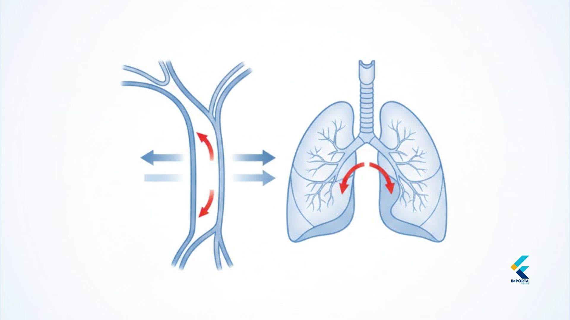 Diagrama médico mostrando a ação da Epinefrina caneta auto injetável no corpo durante uma anafilaxia.